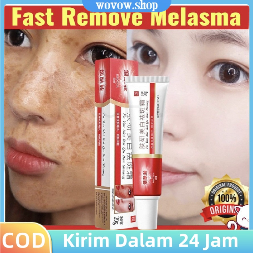 BEOTUA Krim Penghilang Flek Hitam 20g Salep Obat Fu Yan Mei Bai Qu Ban Shuang Beo Tua Freckle Cream 