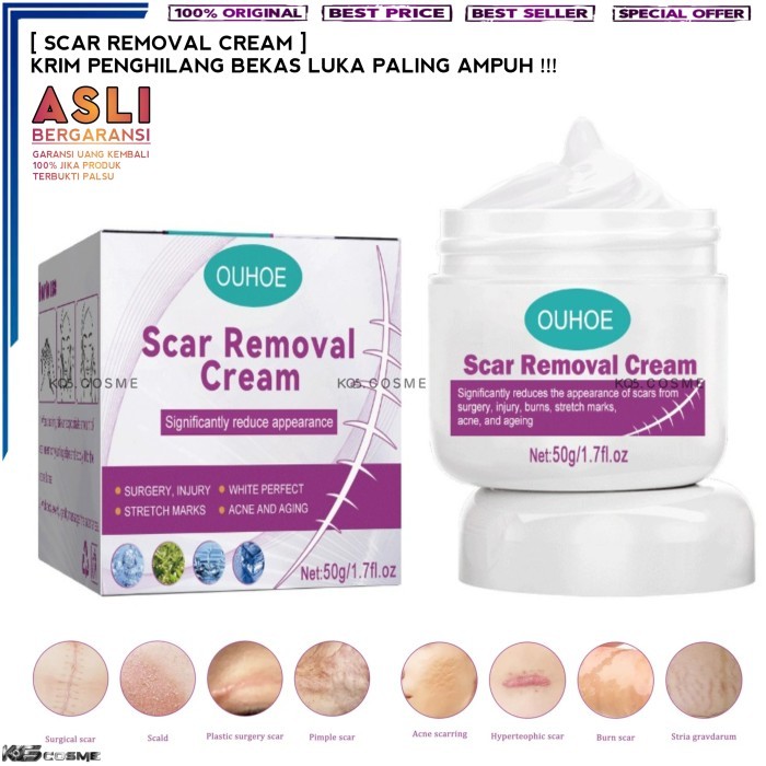 Krim Salep Penghilang Bekas Luka Super Ampuh | Scar Gel Dermatik Bekas Koreng Luka Bakar stretchMark