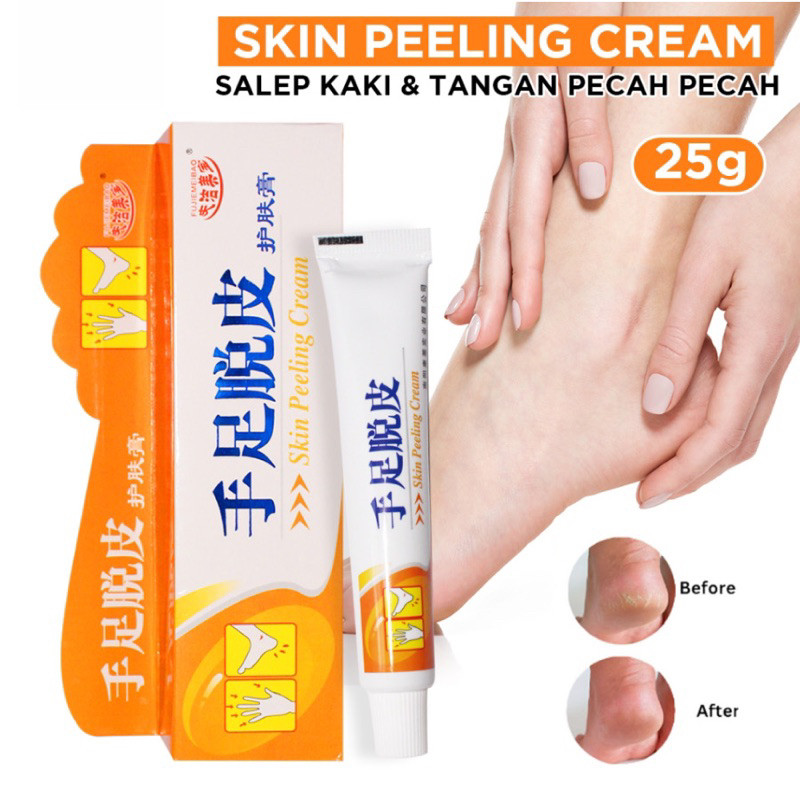 OBAT SALEP TUMIT KAKI TANGAN KAPALAN KERING TEBAL RAYAPAN DAN PECAH AMPUH – SALEP KAKI PECAH