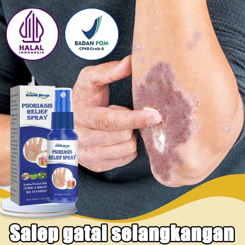 【100% Ori】Salep gatal paling ampuh obat gatal selangkangan obat gatal paling ampuh 30ml Salep gatal 