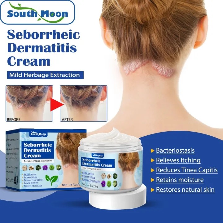 Seborrheic Dermatitis Cream 50g - Obat Dermatitis Seboroik, Psoriasis Perawatan Kulit Seboroik Peraw
