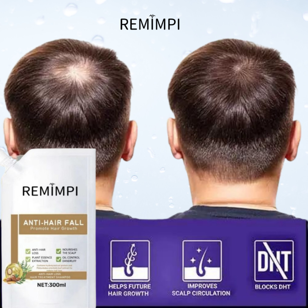 [Remimpi Official] Anti Hair Fall Hair Treatment Shampoo Rambut Rontok dan Kebotakan
