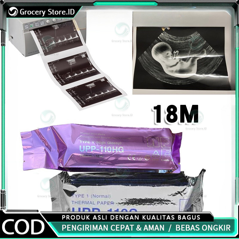

Kertas Usg Sony Paper Sony UPP 110HG / UPP 110S Thermal Paper Kertas Print Thermal Original