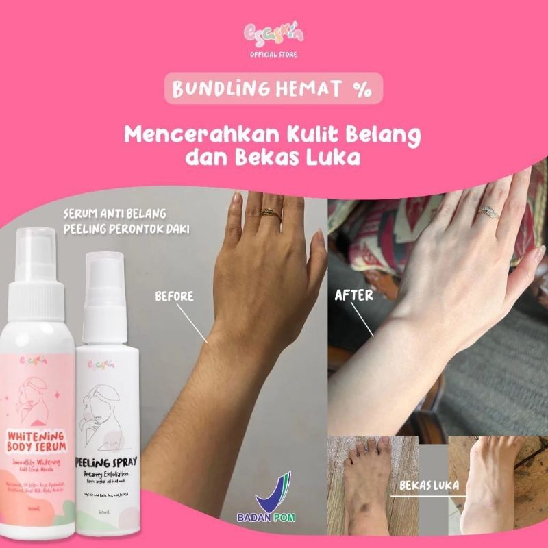 Esaskin Peeling Spray Dan Body Serum Pemutih Badan Viral Esaskin Beauty