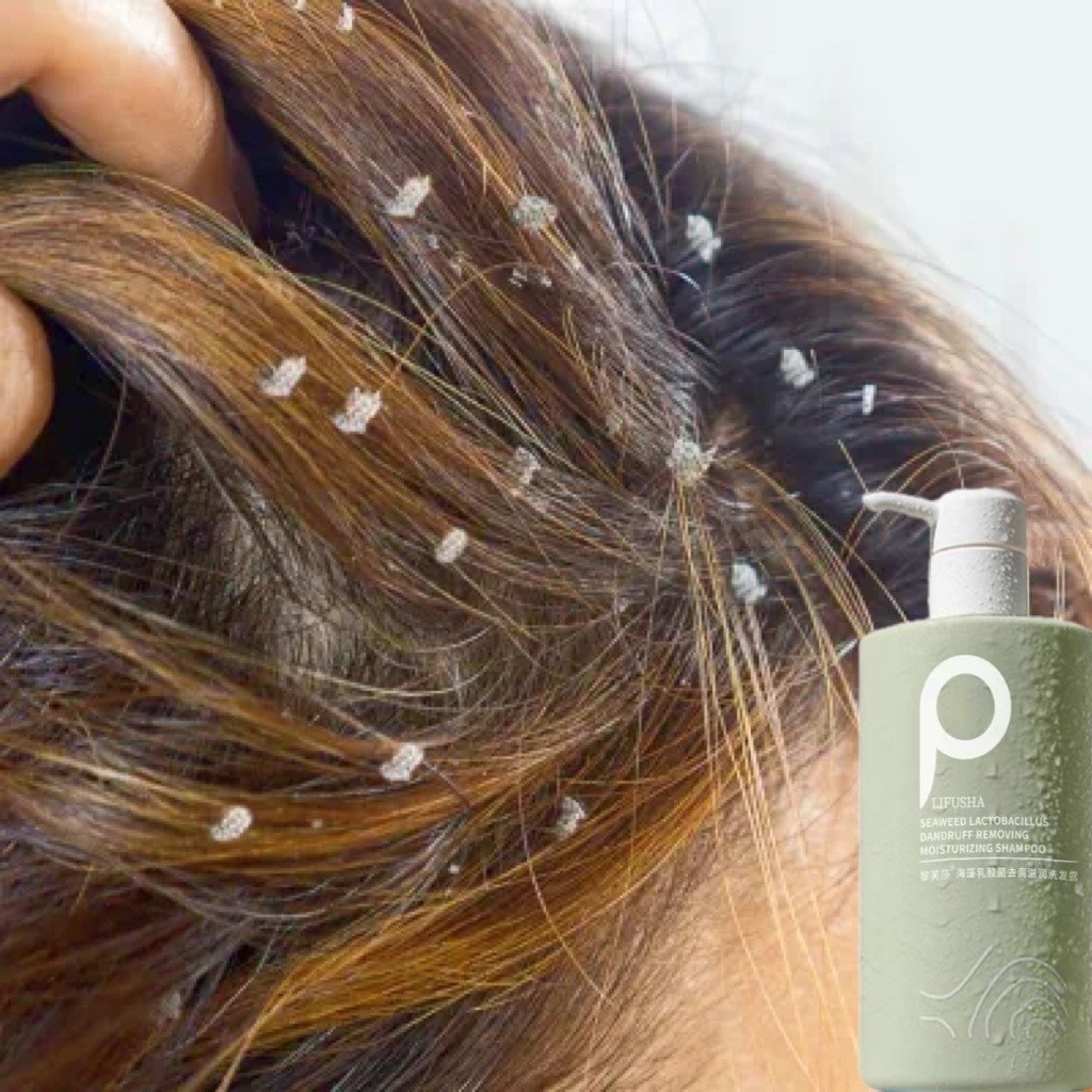 Shampoo Kutu Rambut Shampoo Anti Ketombe Sampo Kutu Sampo Ketombe Shampoo Anti Kutu Shampoo Kutu Ram