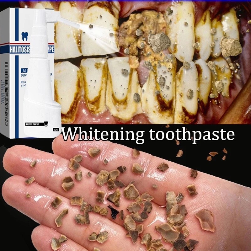 Bma Perontok karang gigi paling ampuh Pembersih karang gigi Penghilang karang gigi 30ml Perontok