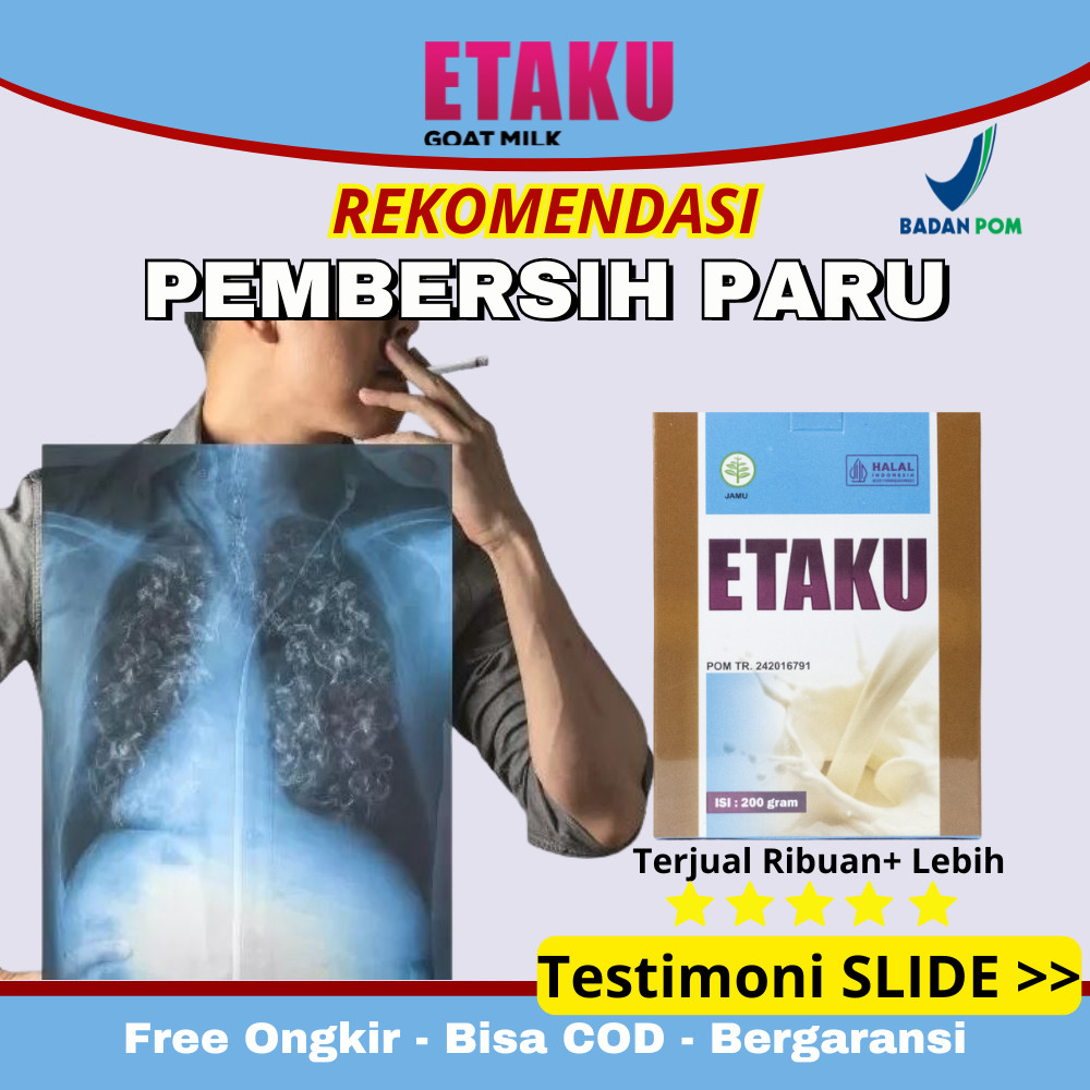 

Susu Pembersih Paru Paru Kotor Perokok Candu Berat obat Asma Sesak Napas TBC Pneumonia Kambing Etawa