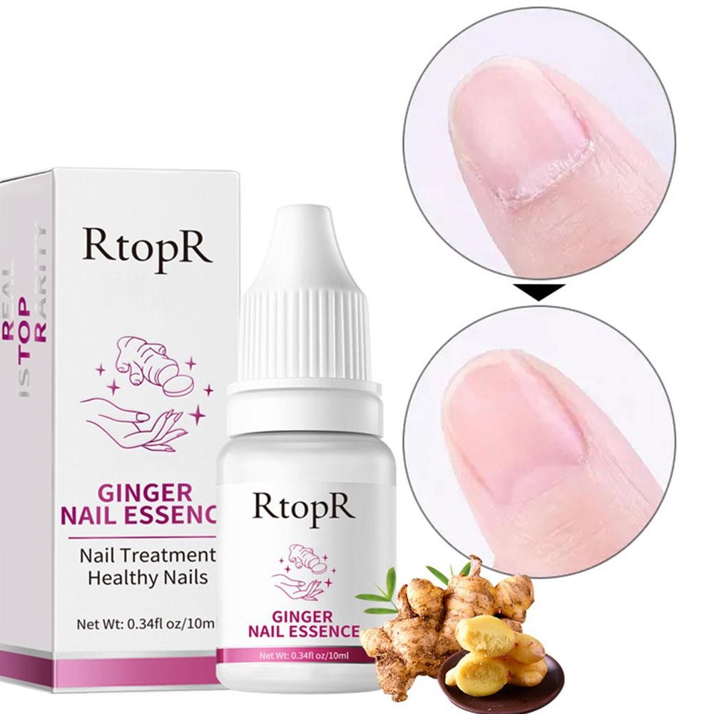 BpomRtopr Ginger Nail Essence Memperbaiki Kuku Antibakteri Tetes Jamur Kuku, Jamur Kuku Kaki Dan