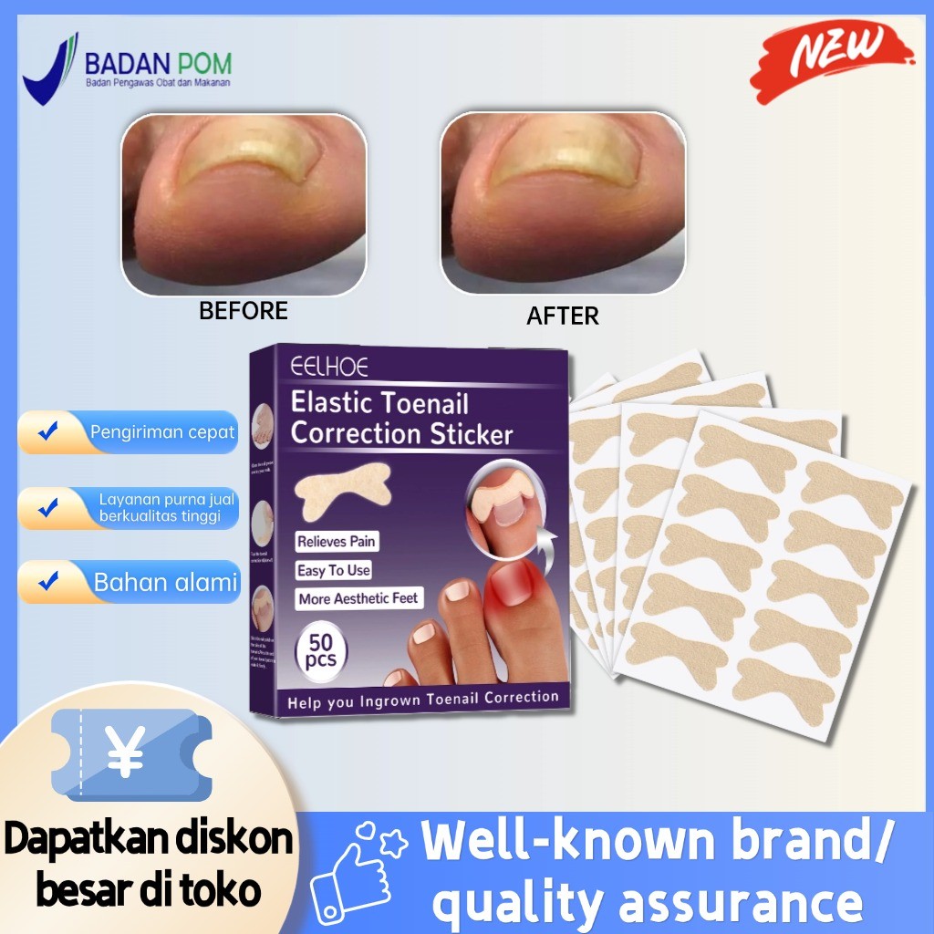 EELHOE elastic toenail sticker 50pcs  Nail Inserts Nail Groove Stiker Kuku Kaki  Nail Repair Ingrown