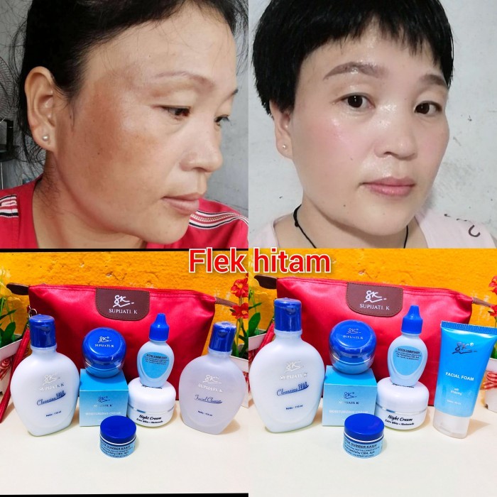 Set Skincare Flek Hitam whitening Supijati K - Foam whitening