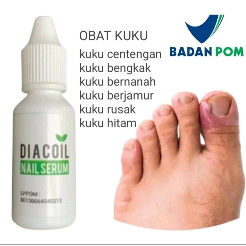 OBAT KUKU CANTENGAN JAMUR KUKU RUSAK DAN BENGKAK AMPUH