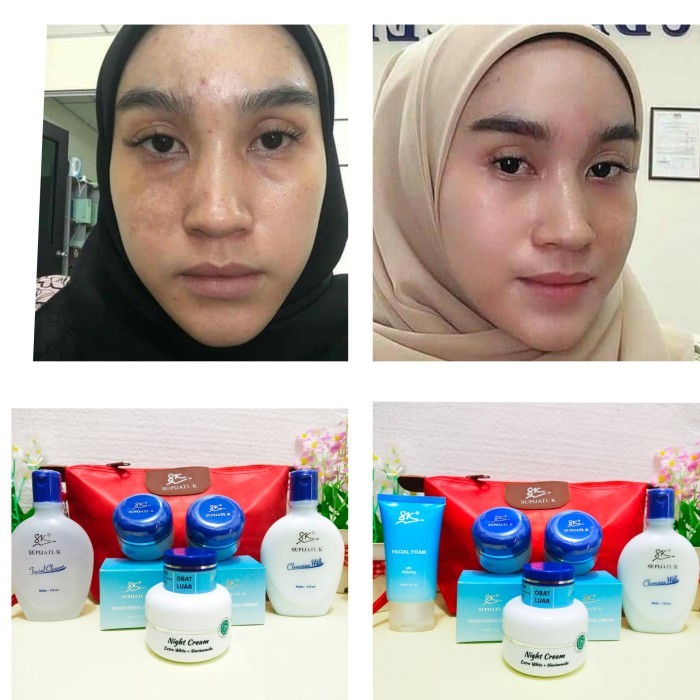 Paket Flek Hitam Extra white skincare Supijati - Facial foam
