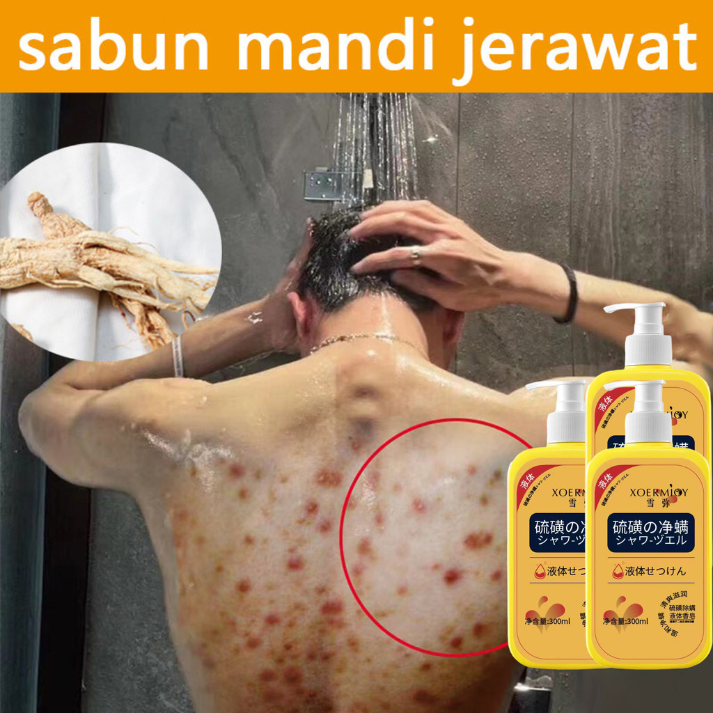 Eczema body wash Pengobatan Eksim psoriasis eksim kering Kurap gatal kulit jamur kulit eksim lotion 