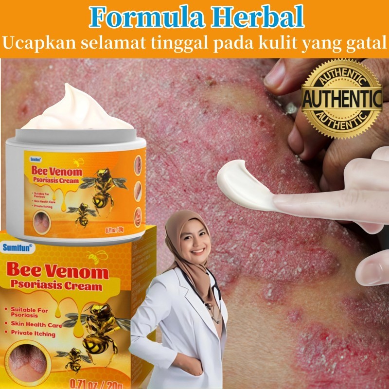 Sumifun Salep Gatal Kulit Ampuh Salep Cina Gatel Exim Kulit Salep Psoriasis Eksim Obat gatal