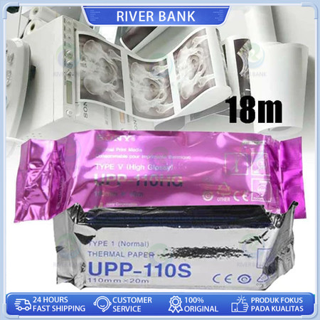 

Kertas Sony Paper USG UPP 110HG type V (High Glossy) Compatible/Kertas USG Sony UPP-110 HG - High Glossy Sony Printer Paper USG UPP 110HG/Kertas USG Sony UPP 110HG Paper Sony Compatibel 1 Box