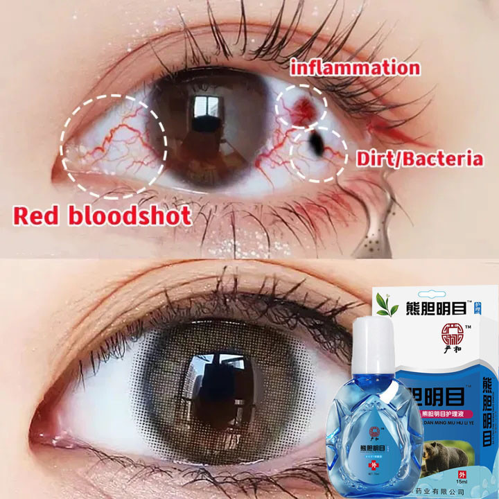 Tetes mata empedu beruang 15ml Mata kering Sakit mata Darah Merah Ketegangan tetes mata softlen Tete