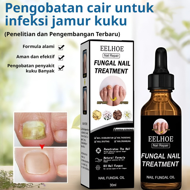 Serum Kuku Jamur Dan Rusak Obat Jamur Kuku Perawatan Kuku Tangan Dan Kaki Oat Kuku Rusak Dan Jamur O