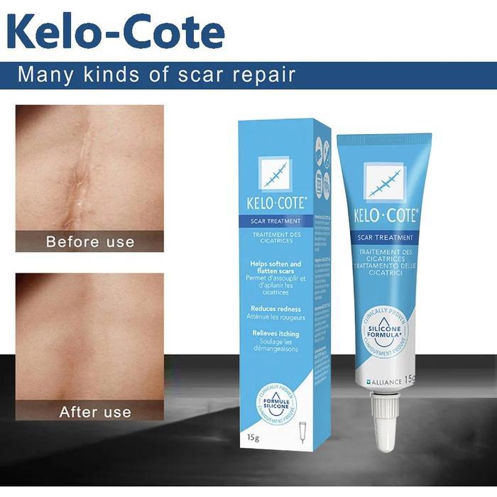 TERLARIS Promo Kelo-Cote Gel / Kelo Cote Bekas Luka Gel / Perawatan Bekas Luka / Krim Bekas Luka / K