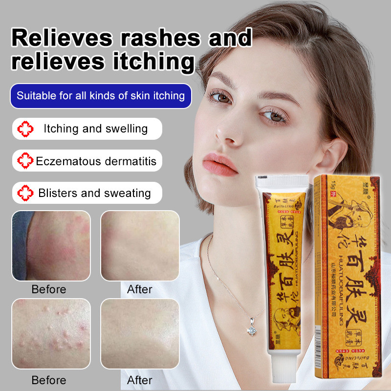 Efektif Atasi Gatal Dan Kemerahan  Salep Kulit Penghilang Gatal Dan Kemerahan Salep Gatal/Krim Gatal