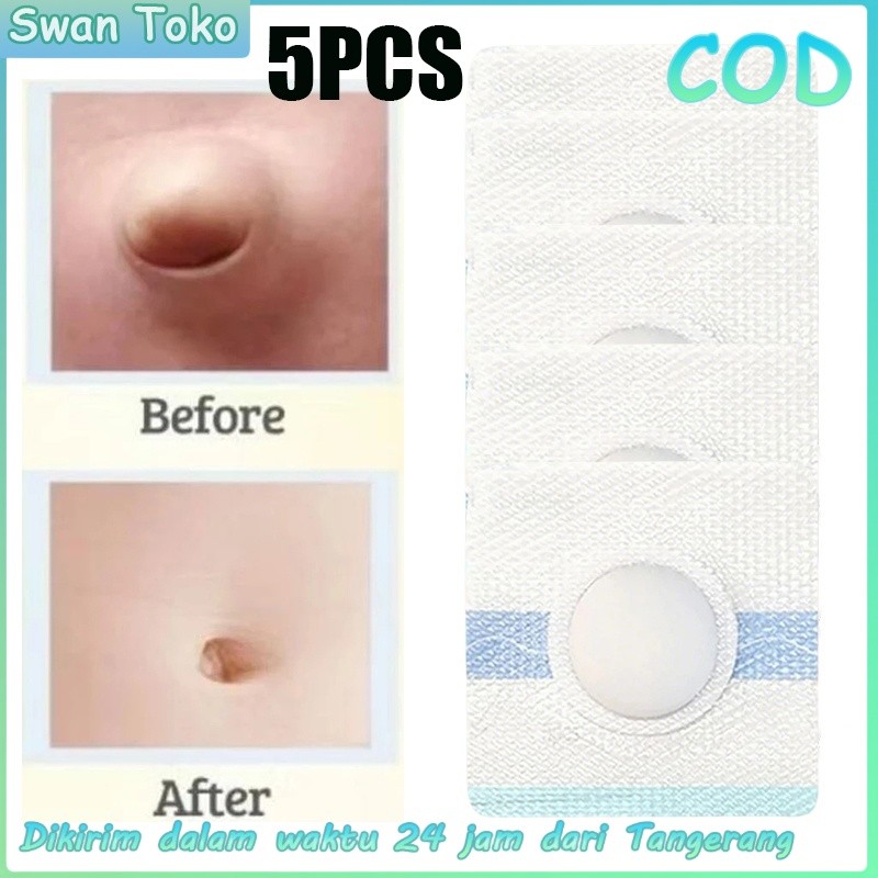 5Pcs Hernia Belt Bayi / Penutup Pusar Bayi Bodong / Koyo Pusar Bodong Bayi Swan