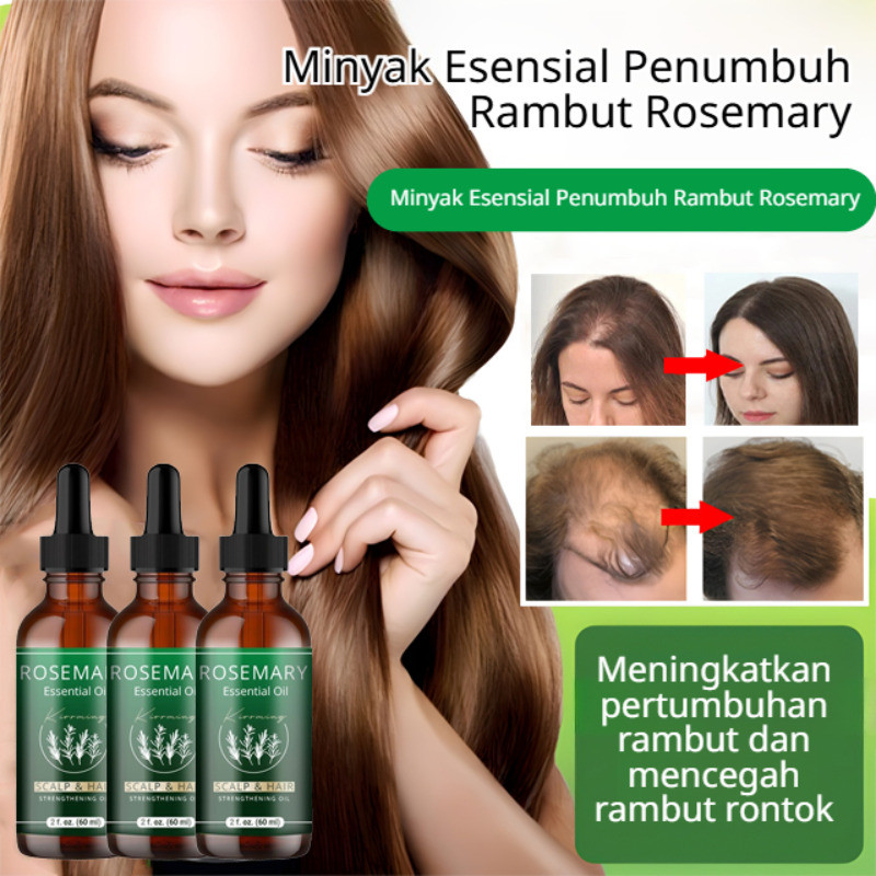 Mengurangi Kerontokan Rambut Cepat  Minyak Esensial Rosemary Untuk Perawatan Dan Pertumbuhan Rambut 