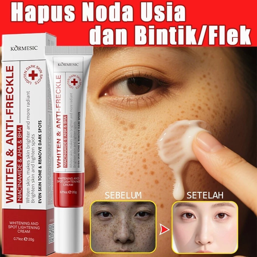 NICOTINAMIDE SPOT WHITENING CREAM | IFN