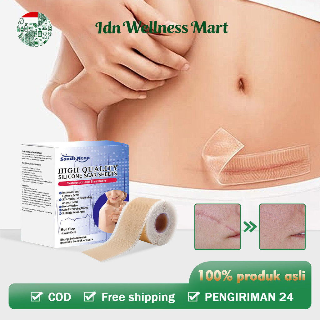South Moon Silicone Scar Sheets 4cmx1.50cm plester silikon penghilang keloid bekas luka Plaster peng