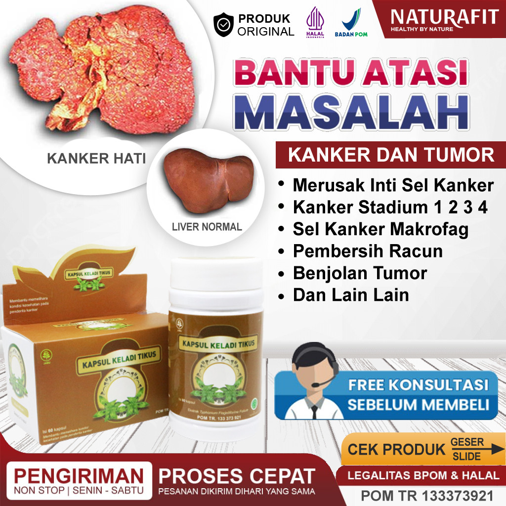 Obat Kanker Hati Paling Ampuh, Tumor Hati Tanpa Operasi, Penyakit Kanker Dan Tumor Liver, Karsinoma 