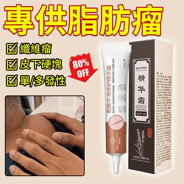 Efektif Mengurangi Lipoma  Krim Perawatan Lipoma HFH Dengan Formula Aman Krim Lipoma/Perawatan Lipom