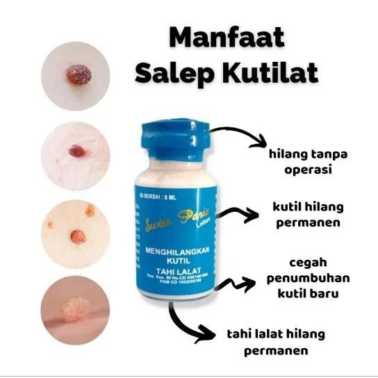Salep Kutilat Original Penghilang Kutil & Tahi Lalat Krim Swiss Paris Lotion