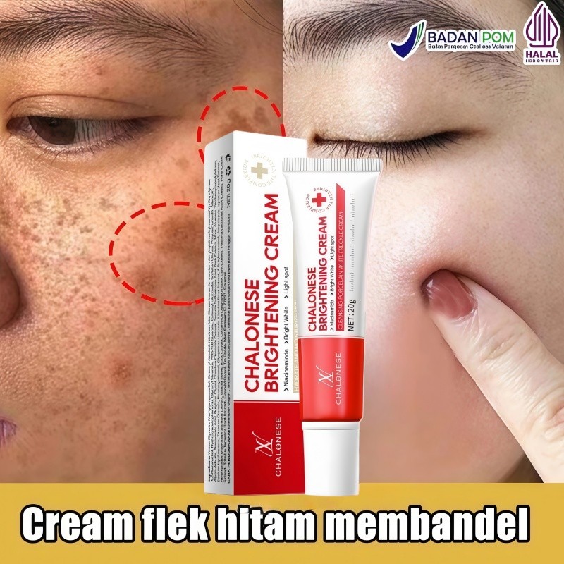 Niacinamide Cream Penghilang Flek Hitam Membandel Salep Pemutih Wajah Glowing Cepat 100% Original Sa