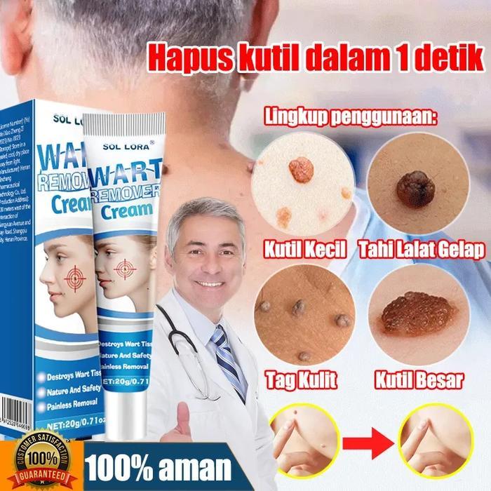 COD -Efek bagus Obat Kutil paling ampuh Oles Penghilang Kutil 20g manjur tanpa operasi mahal penghap