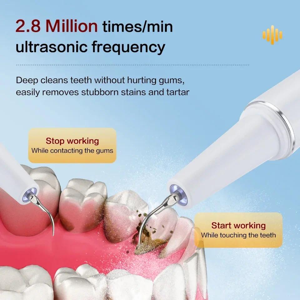 Xiaomi Youpin Dental Scaler Ultrasound Electric Tooth Cleaning Oral Care Plaque Removes Tartar Denta