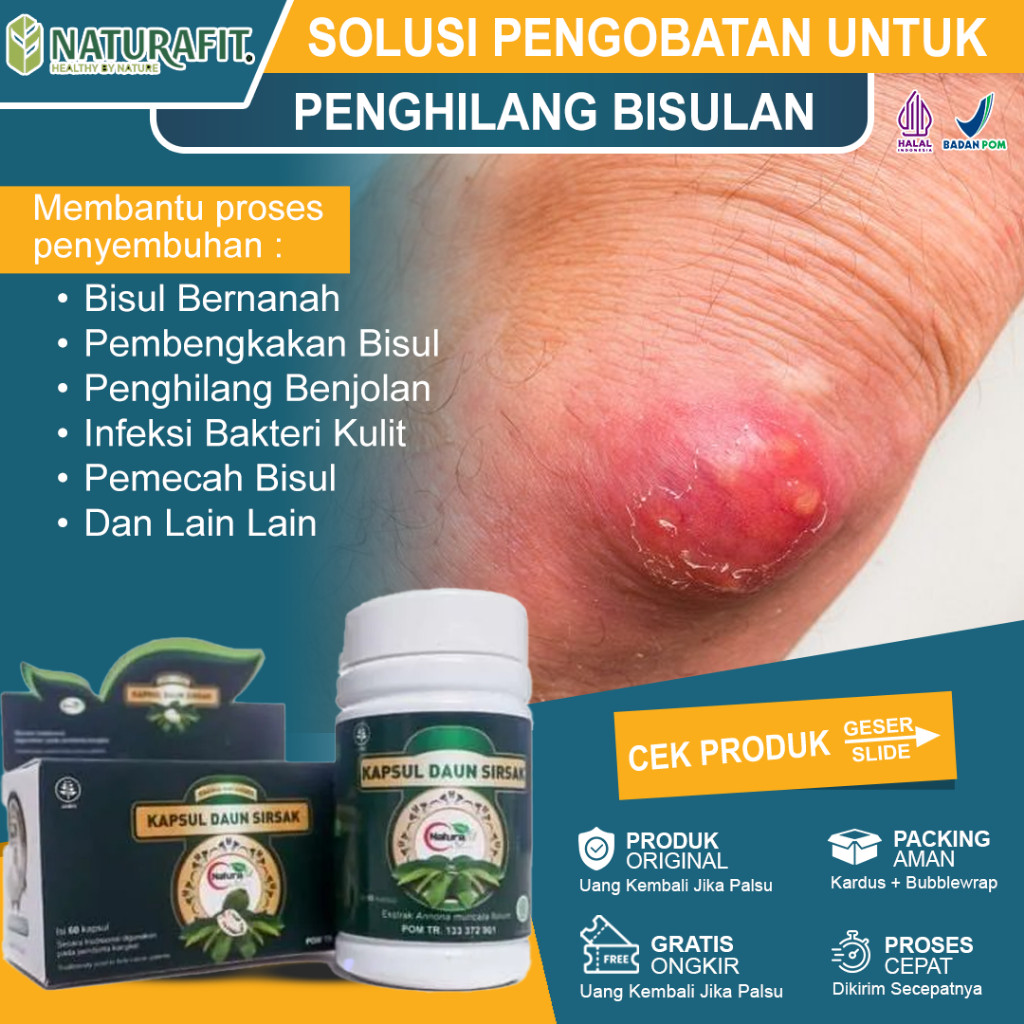 Obat Bisul Paling Ampuh Bisulan Penghilang Benjolan Agar Cepat Pecah Bisul Di Pantat Bengkak Bernana