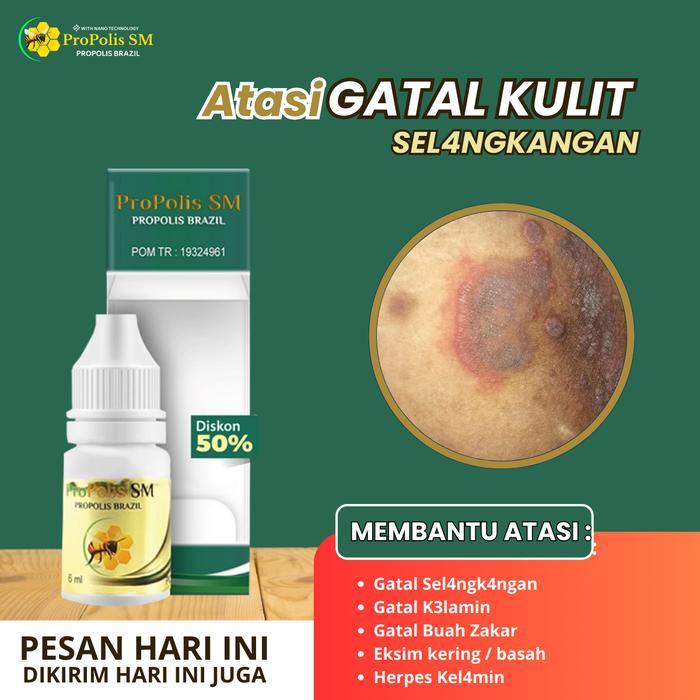 Propolis SM Penghilang Gatal Selangkangan, Gatal K3lamin, Gatal Beruntusan di Pantat, Penghilang Eks
