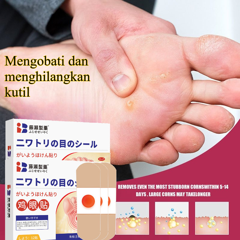 Plester Mata Ikan Plester Obat Kutil Foot Corn Removal Penutup Kutil Obat Mata Ikan Kapalan Caplak P
