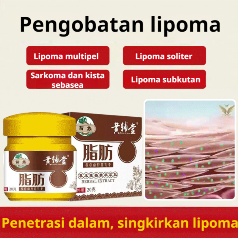 COD+Kirim Dalam 24 Jam lipoma cream original Salep Obat Cream Lipoma Penghilang Lemak removal Benjol