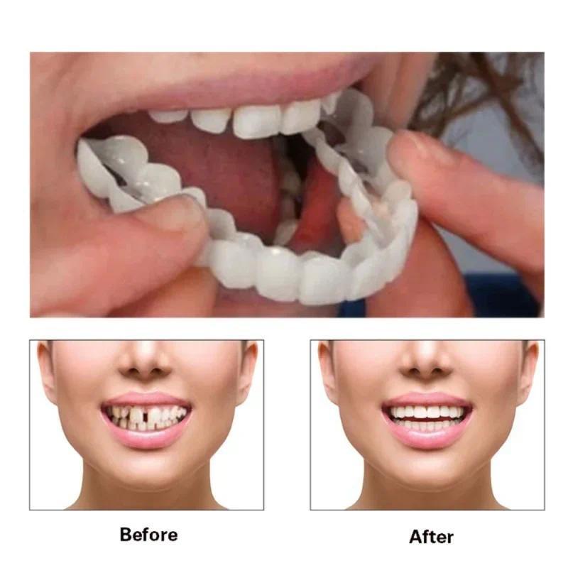 Denture Cover Veneer Snap-on Teeth Kit Fake Temporary Tooth Whitening Replacement Temporary Tooth Re