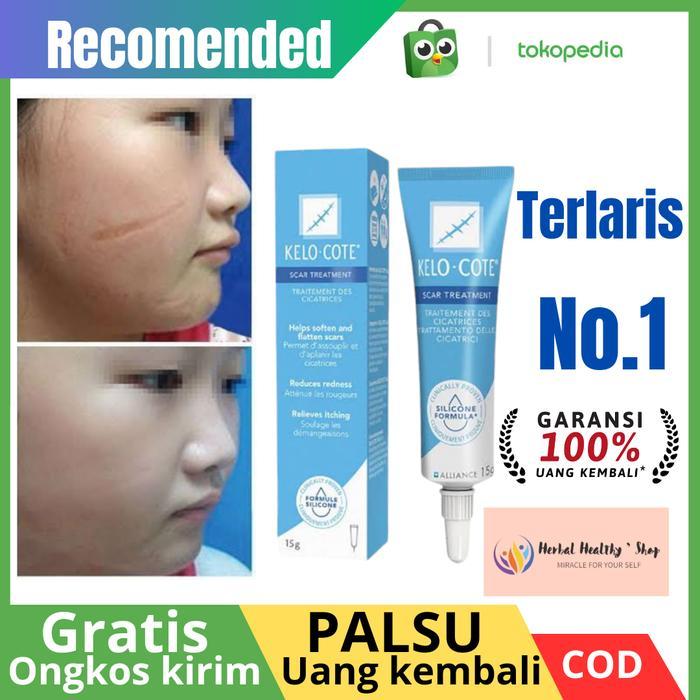 Kelo Cote 15gr Original Gel penghilang bekas luka Operasi ,keloid bekas jerawat dan luka bakar