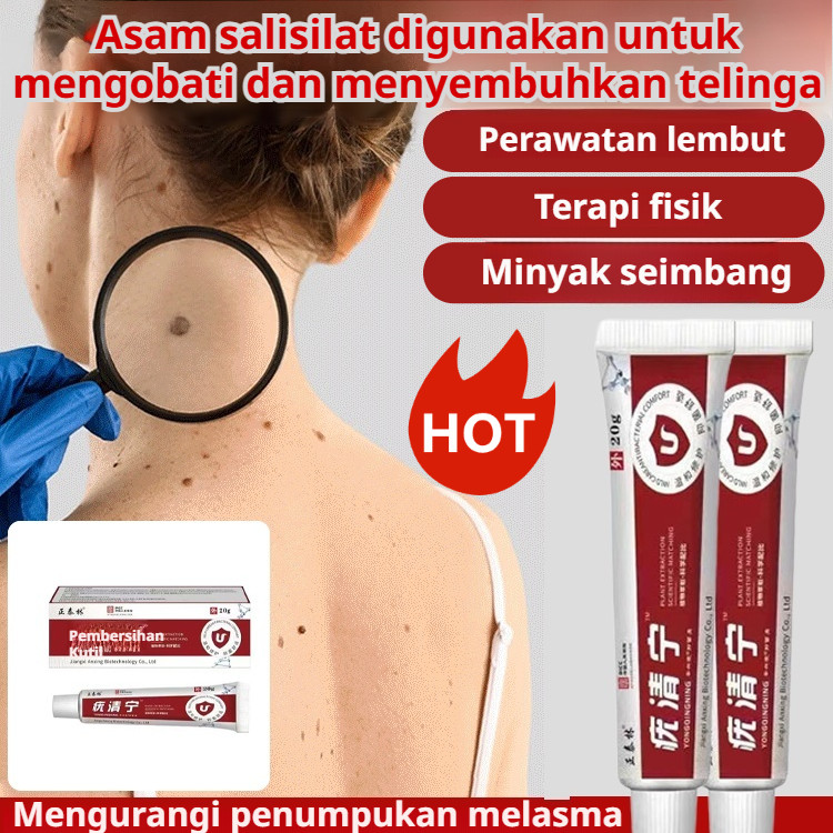 [Asli Beli 1 Gratis 1]Krim Antibakteri Penghilang Kutil Zhengtai Lin / Krim Penghilang Kutil Asam Sa