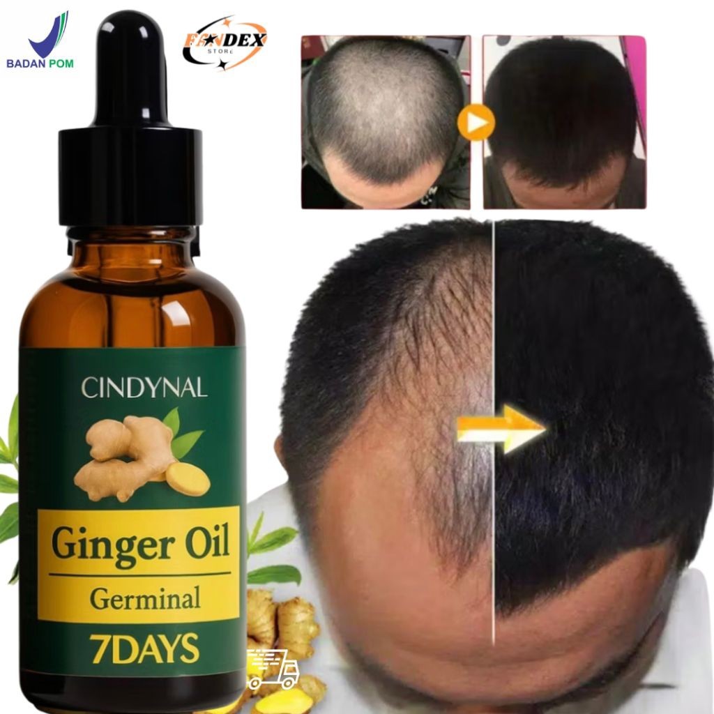 [ BPOM ] SERUM PENUMBUH RAMBUT BOTAK Anti Rontok Botak Asli Obat Uban Penghitam Penyubur Original 7 