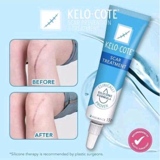 Kelo Cote Gel Salep Asli Penghilang Bekas Luka Operasi Dan Keloid
