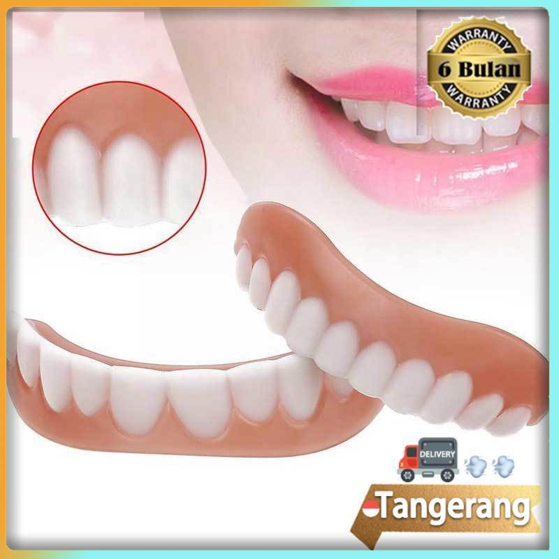 Gigi Palsu Lepas Pasang Perfec Smile Veneer Perawatan Gigi Tiruan