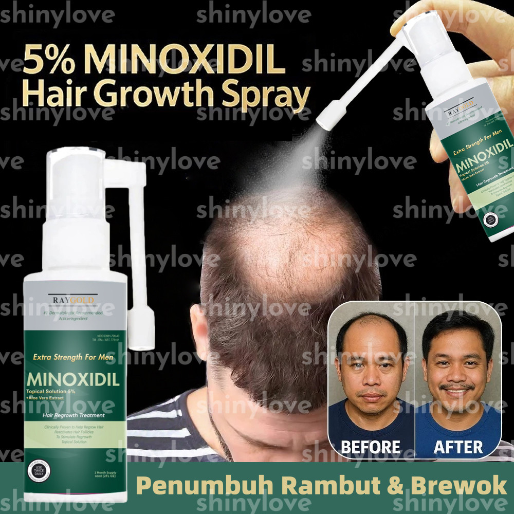 Minoxidil 5% Penumbuh Rambut & Brewok With Aloe Vera For Men Made In Usa - Raygold - Minox Minoksidi