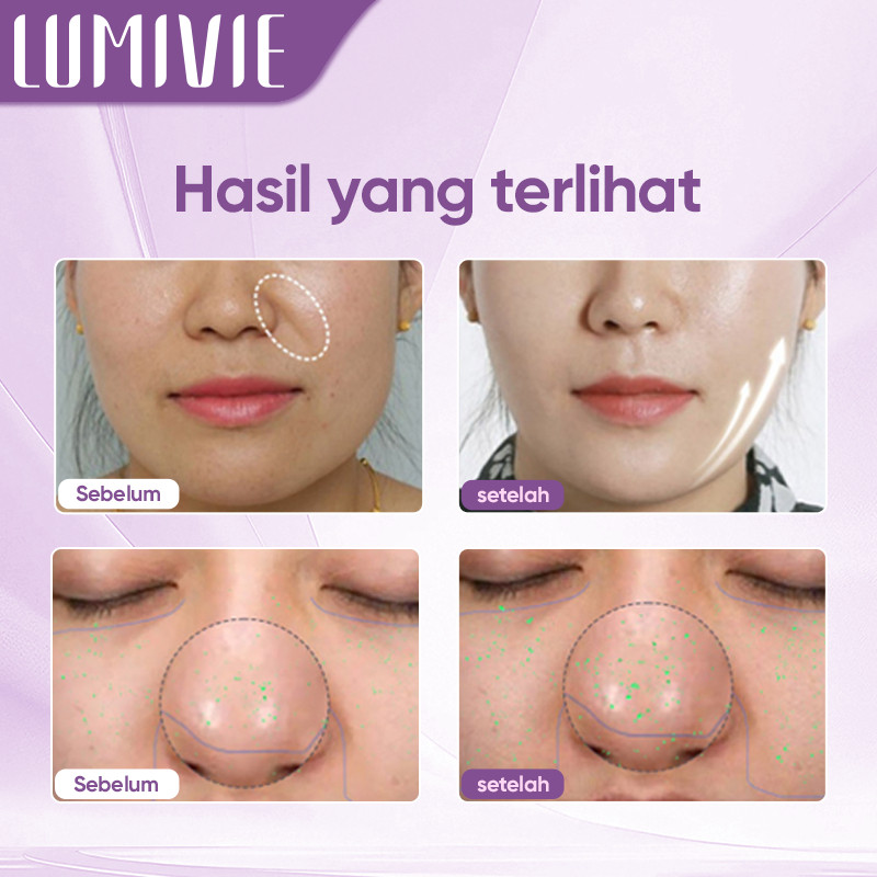 READY LUMIVIE Alat Kecantikan RF Multifungsi Untuk Anti-Aging & Peremajaan Kulit Alat RF Pengencang 