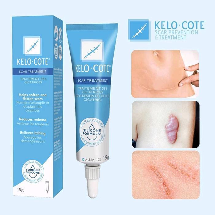 READY KELO COTE Gel Cream Bekas Luka Cream Penghilangan Bekas Luka Operasi Keloid dan Luka Bakar 15 