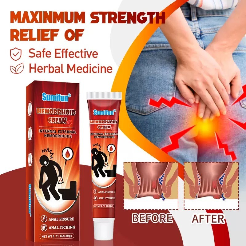 Sumifun Obat Salep Wasir Krim Cream Wasir Ambeien Ambeyen Ambien Dictamni 100% Original Herbal Ampuh
