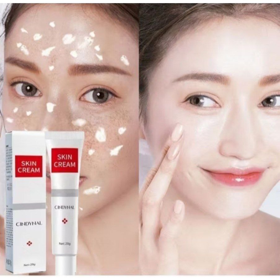 Krim bintik Niacinamide | BSM