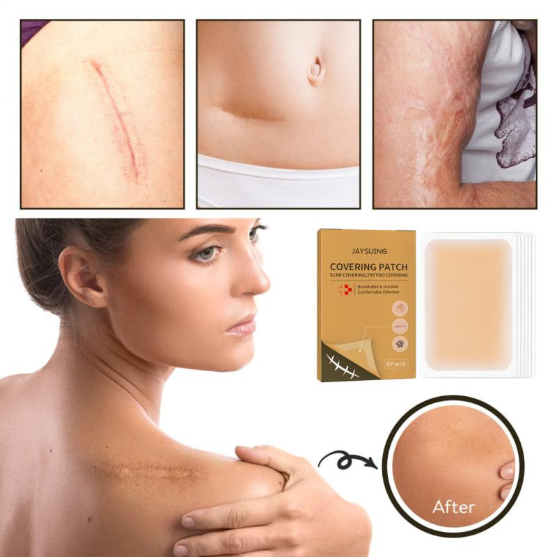 Skin Invisible Concealer Stiker Tato Bekas Luka Menutupi Kulit Tahan Air Pita Warna Kulit Palsu tatt