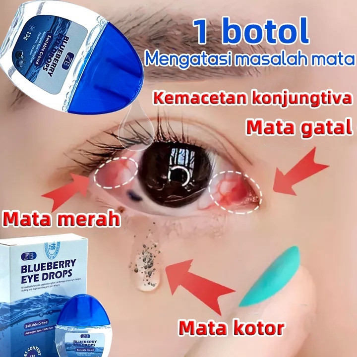 Obat Tetes Mata Obat Mata minus Tetes Mata minus Katarak Silinder Obat 15ml